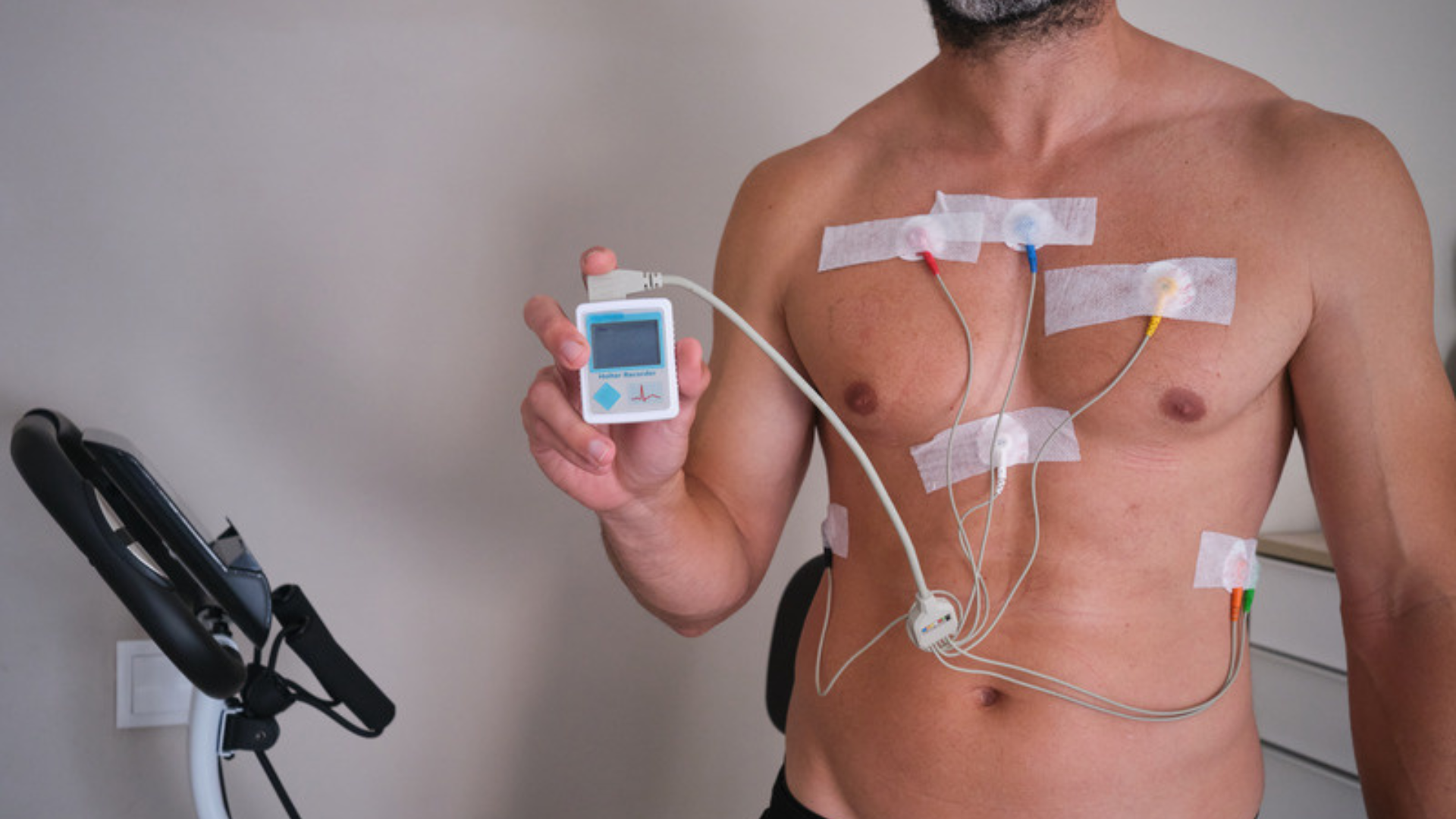 Registratore Holter con elettrodi applicati sul torace per la registrazione dell'elettrocardiogramma nelle 24 ore
